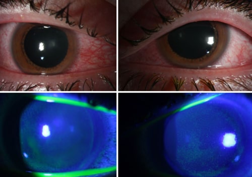 What is the Smell from UV Light and How to Avoid It